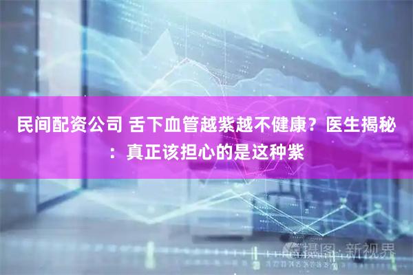 民间配资公司 舌下血管越紫越不健康?医生揭秘:真正该担心的是这种紫